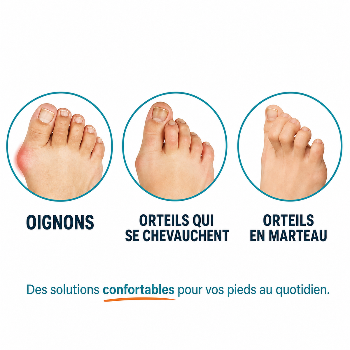 Align'Orteils™ | Correcteur et séparateur d'orteils - Veluna